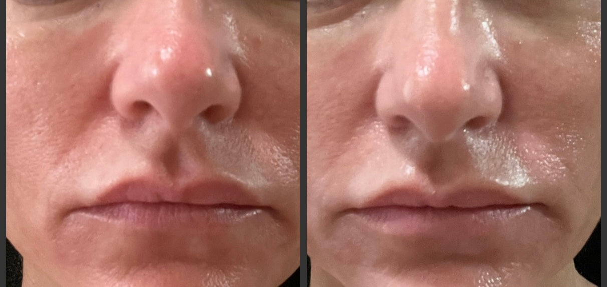 Elta MD UV Skin Recovery